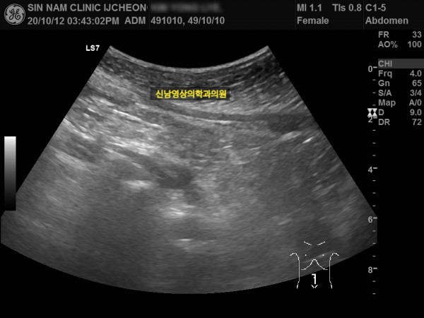 0ac7375d2de753c51699b4acef1b4092_1758768